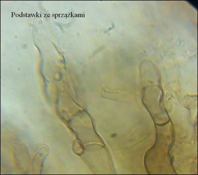 Tomentella stuposa