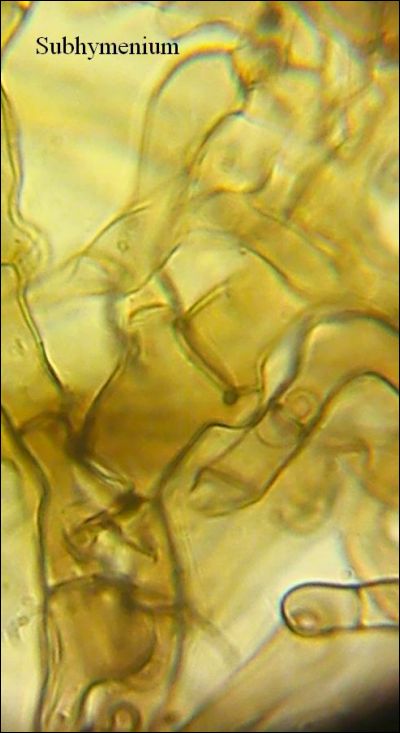 Tomentella stuposa