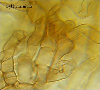 Tomentella stuposa