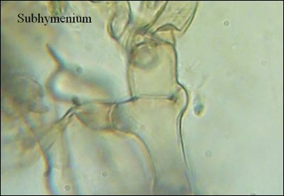 Tomentella stuposa
