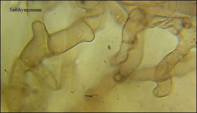 Tomentella stuposa