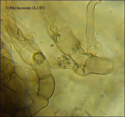 Tomentella stuposa