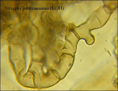 Tomentella stuposa