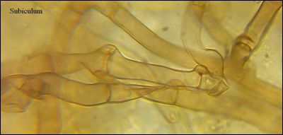 Tomentella stuposa