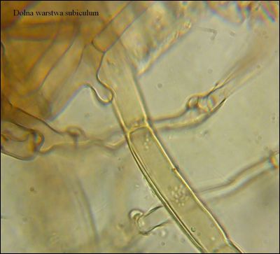 Tomentella stuposa