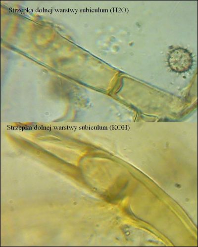 Tomentella stuposa