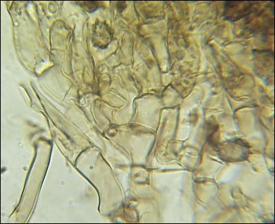 Tomentella wakefieldiae
