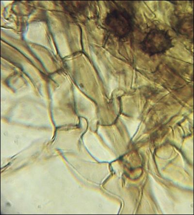 Tomentella wakefieldiae
