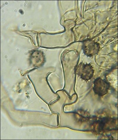 Tomentella wakefieldiae