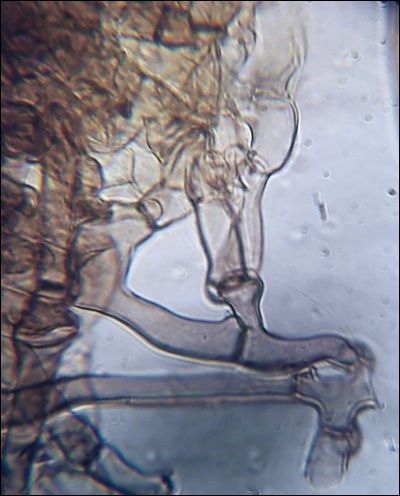 Tomentella wakefieldiae