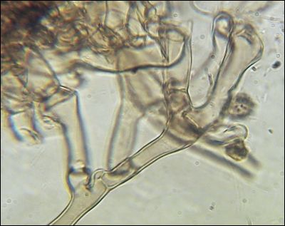 Tomentella wakefieldiae