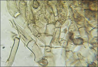 Tomentella wakefieldiae
