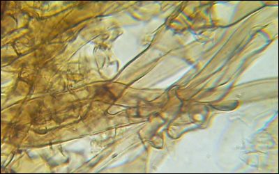 Tomentella wakefieldiae