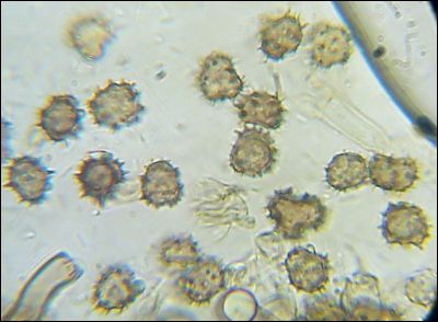Tomentella wakefieldiae