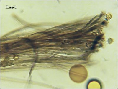 Tomentella wakefieldiae