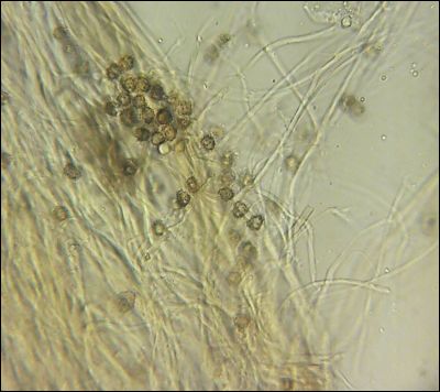 Tomentella wakefieldiae