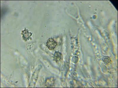 Tomentellopsis zygodesmoides