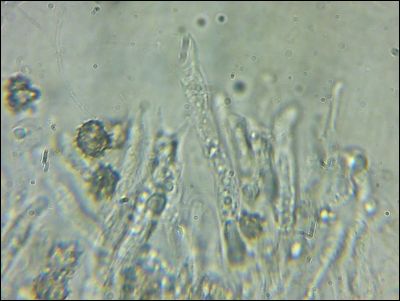 Tomentellopsis zygodesmoides