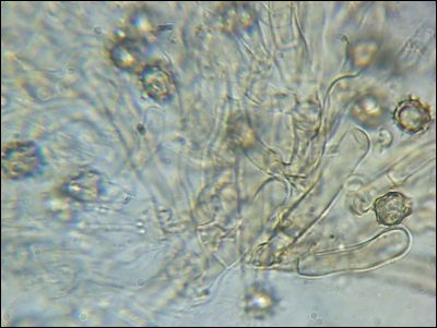 Tomentellopsis zygodesmoides