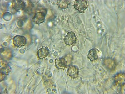 Tomentellopsis zygodesmoides