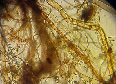 Tomentellopsis zygodesmoides