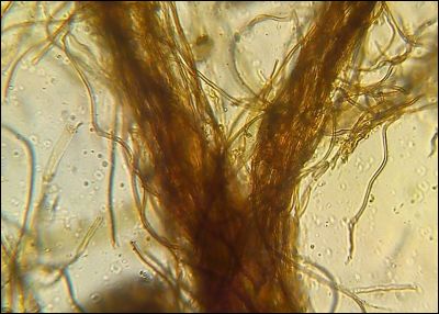 Tomentellopsis zygodesmoides