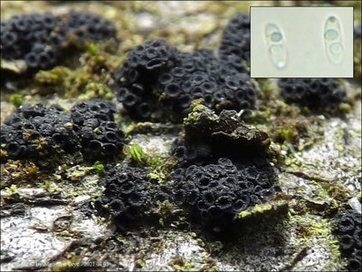 Tympanopsis